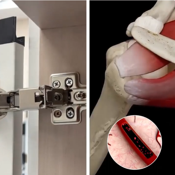 The Real Reason Your Shoulder Won't Heal